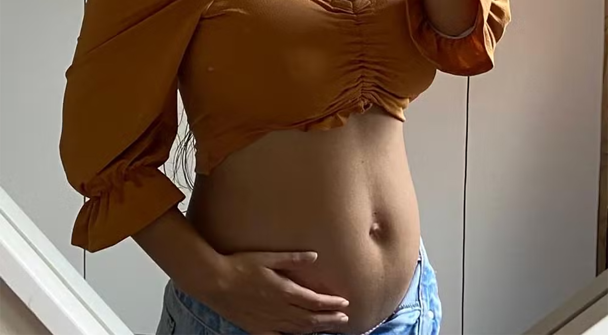 Mulher engravida de dois bebés em momentos diferentes apesar de usar anticoncepcional